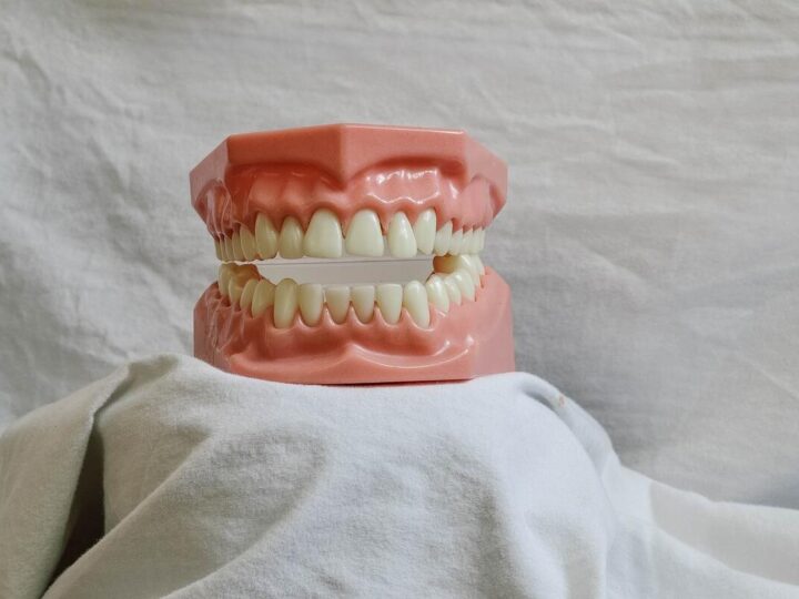 ClearChoice Dental Implants: A Game-Changer in Restorative Dentistry